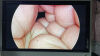 STRYKER 1288-210-105 Arthroscopic Video System