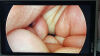 STRYKER 1288-210-105 Arthroscopic Video System