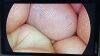 STRYKER 1288-210-105 Arthroscopic Video System