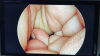 STRYKER 1288-210-105 Arthroscopic Video System