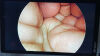 STRYKER 1288-210-105 Arthroscopic Video System