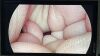 STRYKER 1288-210-105 Arthroscopic Video System