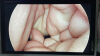 STRYKER 1288-210-105 Arthroscopic Video System
