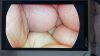 STRYKER 1288-210-105 Arthroscopic Video System