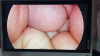 STRYKER 1288-210-105 Arthroscopic Video System