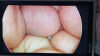 STRYKER 1288-210-105 Arthroscopic Video System
