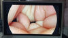 STRYKER 1288-210-105 Arthroscopic Video System