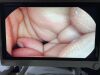 STRYKER 1188 Urology HD Camera Head -31130 TESTED