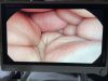 STRYKER 1188 Urology HD Camera Head -31130 TESTED