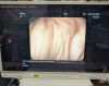 PENTAX EG-1690K Gastroscope