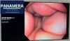 OLYMPUS GIF-Q180 Gastroscope
