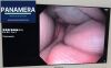 OLYMPUS GIF-Q180 Gastroscope