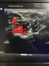 PHILIPS L12-5 Ultrasound Transducer