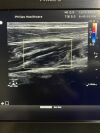 PHILIPS L12-5 Ultrasound Transducer