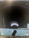 BK MEDICAL 8808E Ultrasound - Urology
