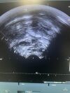 BK MEDICAL 8808E Ultrasound - Urology