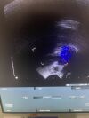 BK MEDICAL 8808E Ultrasound - Urology