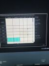 BK MEDICAL 8808E Ultrasound - Urology