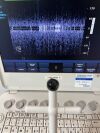PHILIPS CX50 Ultrasound - Cardiac