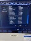 PHILIPS CX50 Ultrasound - Cardiac