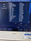 PHILIPS CX50 Ultrasound - Cardiac