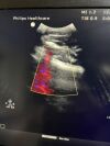 PHILIPS C5-1 Ultrasound Transducer