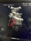 PHILIPS C5-1 Ultrasound Transducer