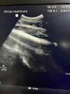 PHILIPS C5-1 Ultrasound Transducer