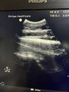 PHILIPS C5-1 Ultrasound Transducer