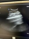 PHILIPS C9-2 Compact PureWave Ultrasound Transducer