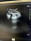 PHILIPS C9-2 Compact PureWave Ultrasound Transducer