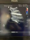 PHILIPS C5-1 Ultrasound Transducer