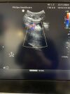PHILIPS C5-1 Ultrasound Transducer