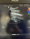 PHILIPS C5-1 Ultrasound Transducer