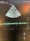 GE 6Tc Ultrasound Transducer