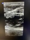 PHILIPS MEDICAL L15-7io Ultrasound Transducer