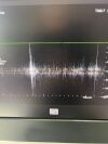 PHILIPS D2CwC Ultrasound Transducer