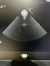 PHILLIPS Transesophageal X7-2T Compact Ultrasound Transducer