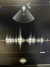 PHILLIPS Transesophageal X7-2T Compact Ultrasound Transducer