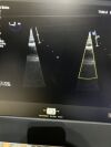 PHILLIPS Transesophageal X7-2T Compact Ultrasound Transducer