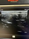 PHILIPS L12-3 Ultrasound Transducer