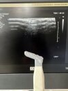 PHILIPS Affiniti 70G Ultrasound System