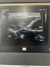 PHILIPS Affiniti 70G Ultrasound System