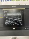 PHILIPS Affiniti 70G Ultrasound System