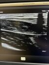 PHILIPS L12-3 Ultrasound Transducer
