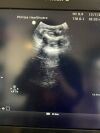PHILIPS C5-1 Ultrasound Transducer