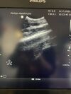 PHILIPS C5-1 Ultrasound Transducer
