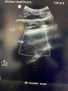 PHILIPS C5-1 Ultrasound Transducer