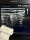 PHILIPS L12-5 Ultrasound Transducer