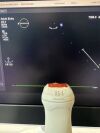 PHILIPS X5-1 Ultrasound Transducer